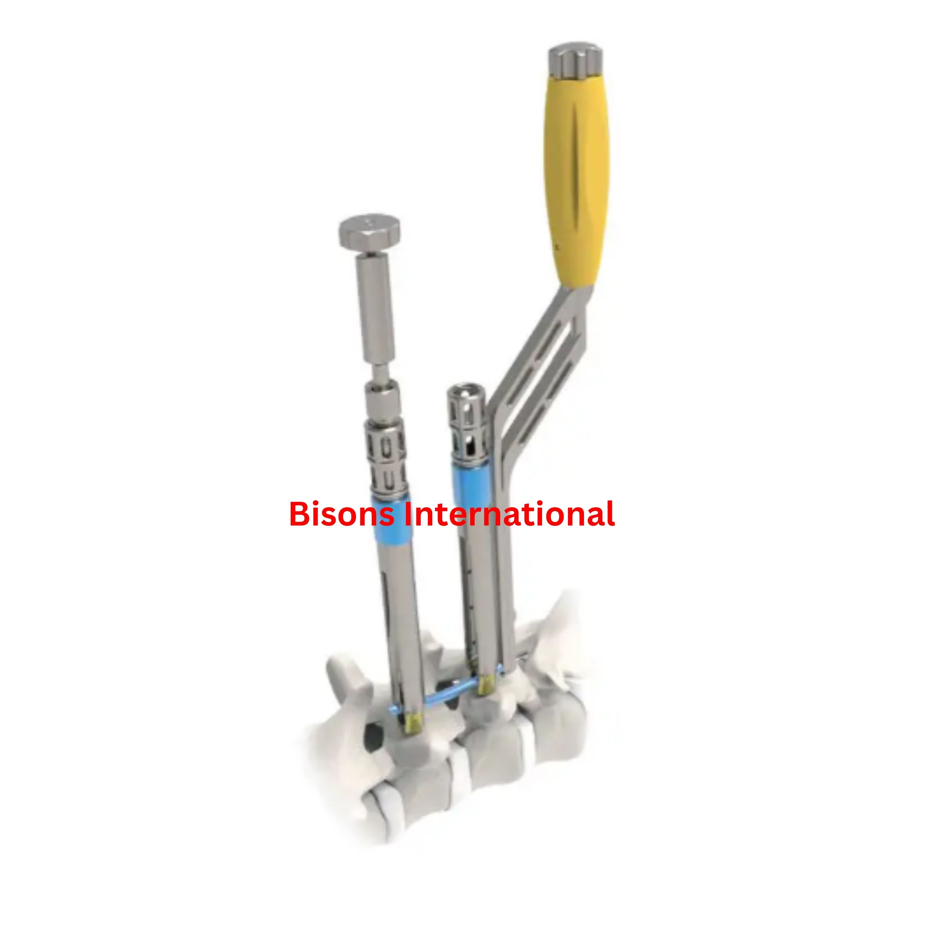 Pedicle Screw Positioning System for Minimally Invasive Spine Surgery